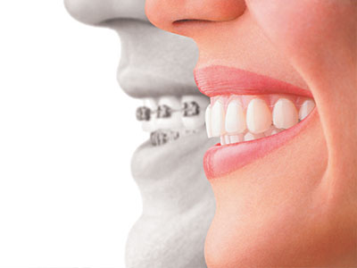 The image is a composite of two photos  one shows a smiling woman s face, and the other displays a mouth with teeth.