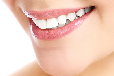 Close-up of a smiling woman with teeth whitening product, highlighting oral care.