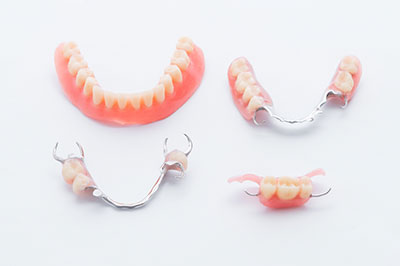 The image shows a set of dental implants, including two upper front teeth and one lower front tooth, displayed on a white background.