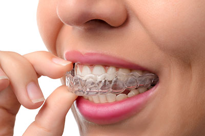 The image shows a person with braces, holding a toothpaste tube in their hand.