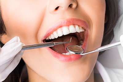 Woman with open mouth wearing dental mask, holding toothbrush.