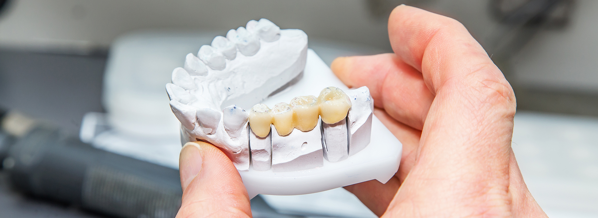 The image shows a person holding a toothbrush with bristles, likely demonstrating dental hygiene or preparing to brush teeth.