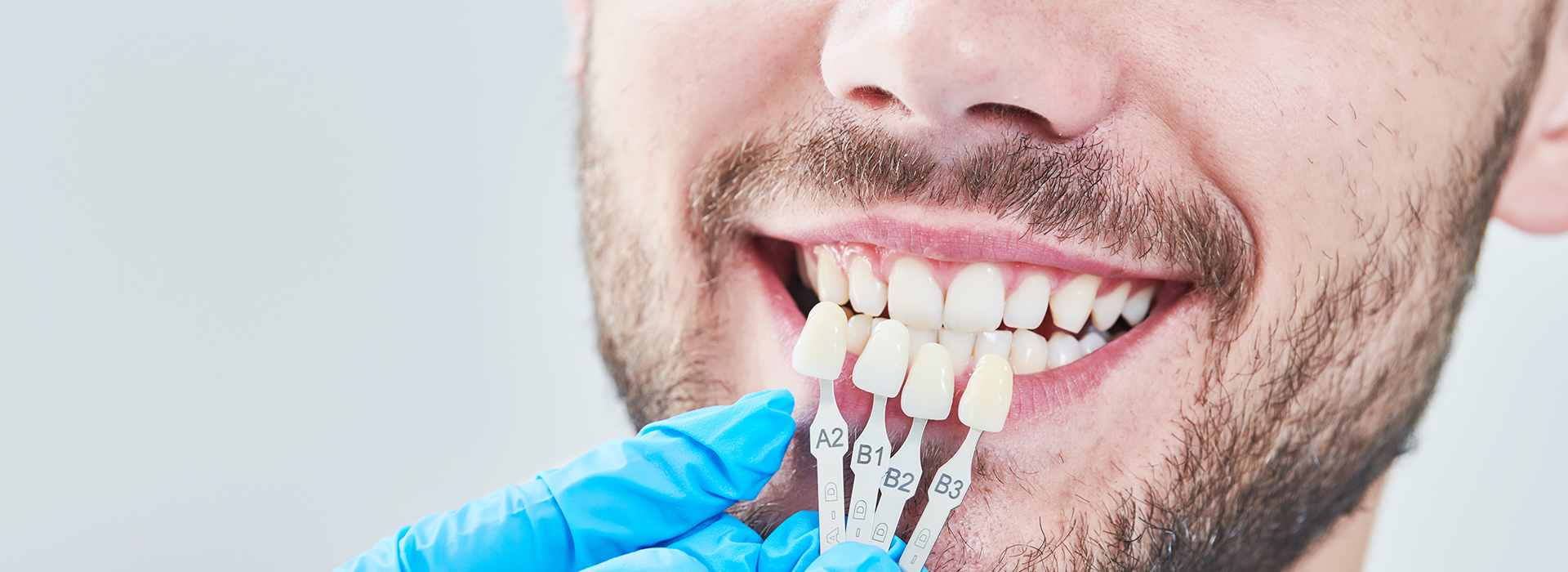 The image shows a man with a toothy grin, wearing a blue surgical mask and holding his mouth open. He appears to be in the process of receiving dental treatment or care, as suggested by the presence of dental instruments and the dental setting in the background.